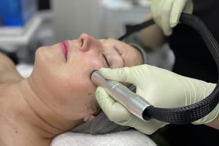 Microdermabrasion