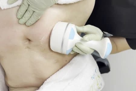 Cavitation