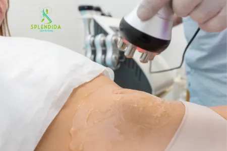 Radiofrequency Body