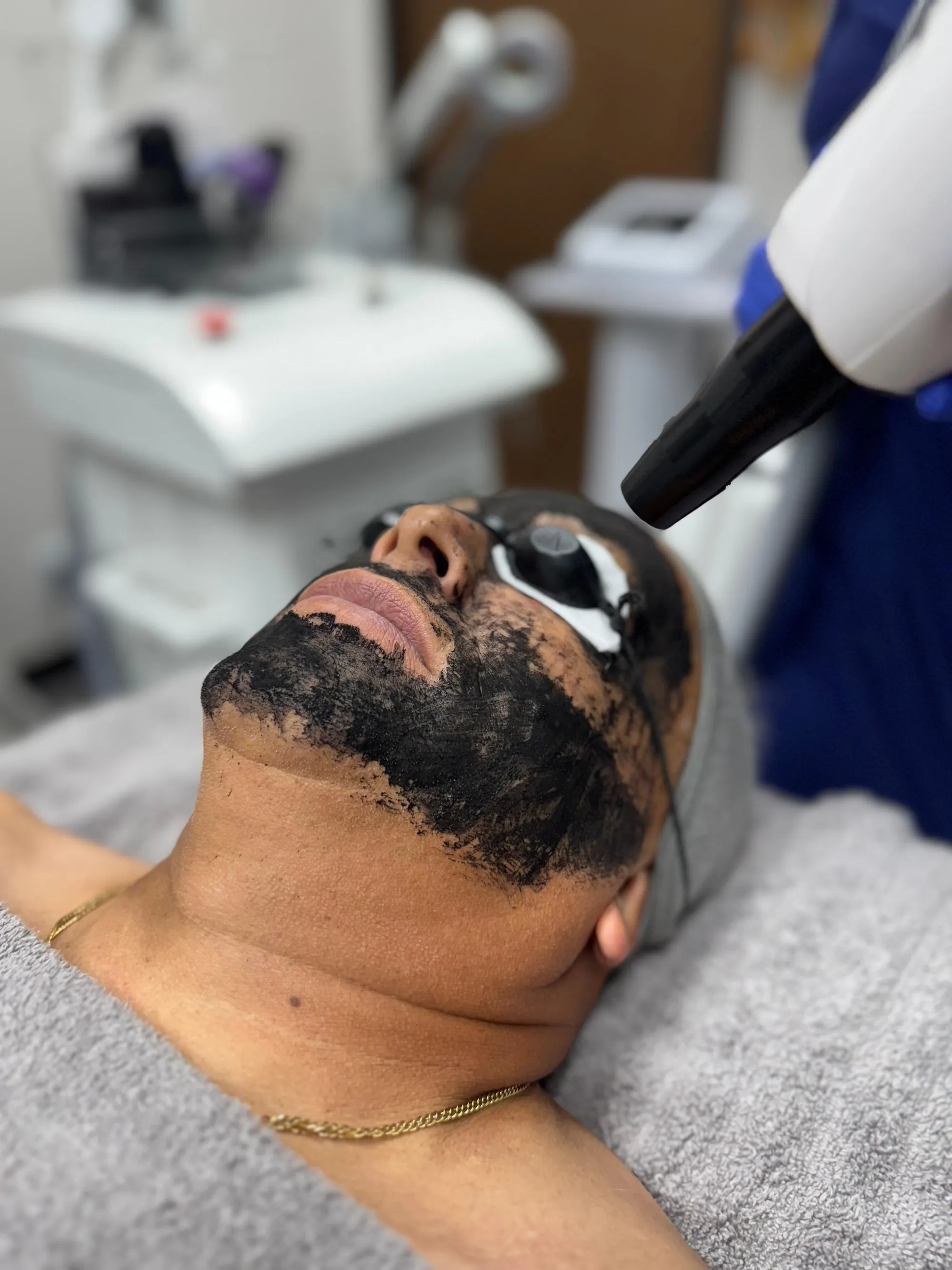 Hollywood Carbon Facial