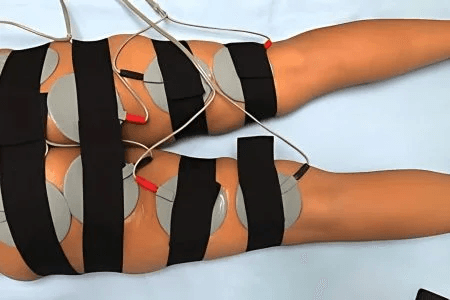 Russian Current Electroestimulation
