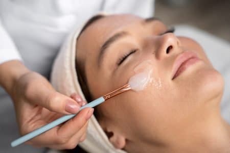 Chemical Peels: Types, Benefits, and What to Expect