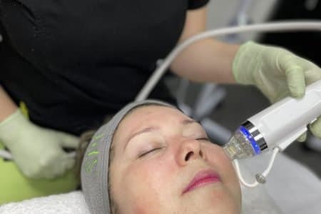 Morpheus 8: The Revolutionary Fractional Treatment for Skin Tightening