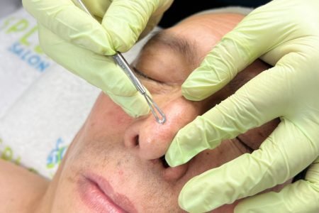 DEEP CLEASING WITH EXTRACTIONS
